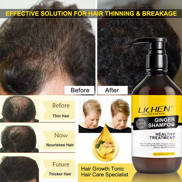 Organic Lichen Ginger Shampoo (500ml)